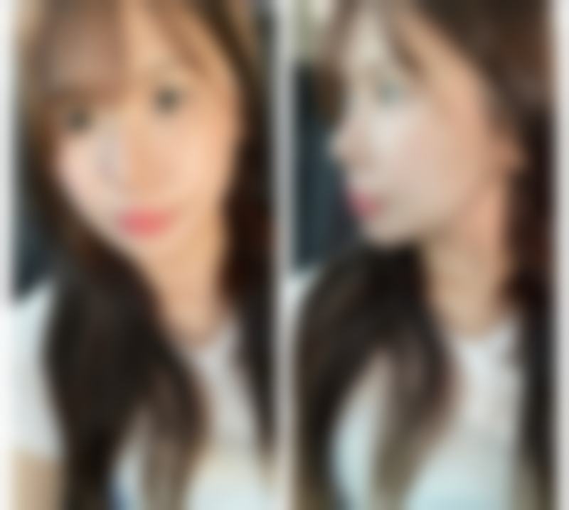 北京正美整形医疗美容诊所患者评价