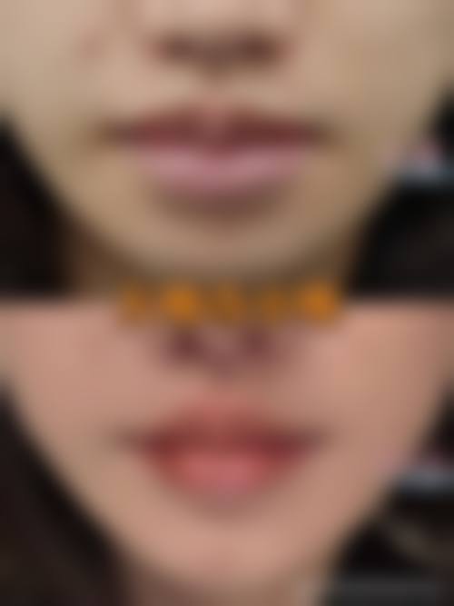 陈燕喜患者评价