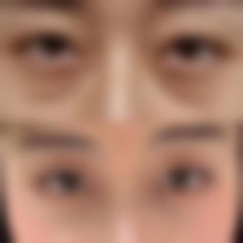 韩国MOODON整形外科患者评价