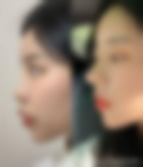 天津熙朵丽尊植发整形医院患者评价