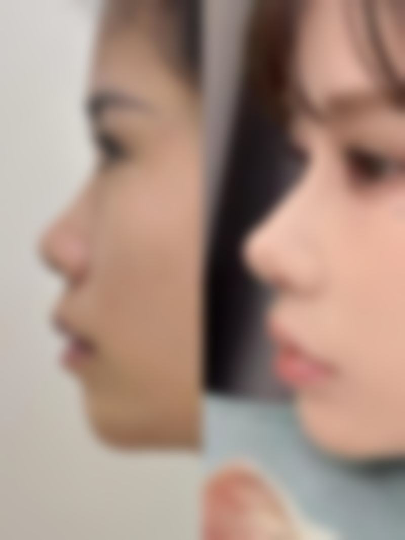 商丘爱艺星美容院核心项目