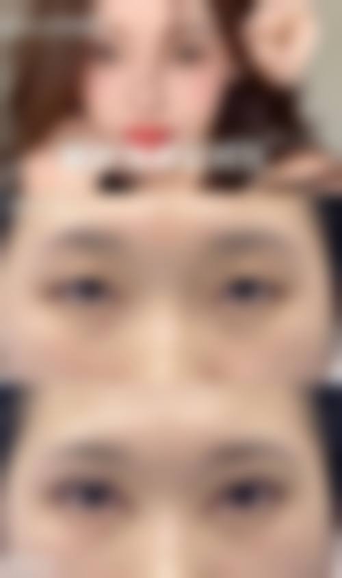 宁强县熙美女王整形医院核心项目