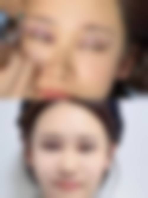 宁强县熙美女王整形医院交通路线及预约