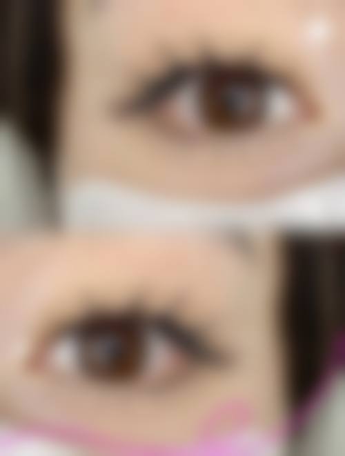 无锡虹桥医院医疗美容科(植发专精)交通路线及预约