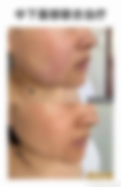 2026 河北医 科 大学中医院美容科价格参考