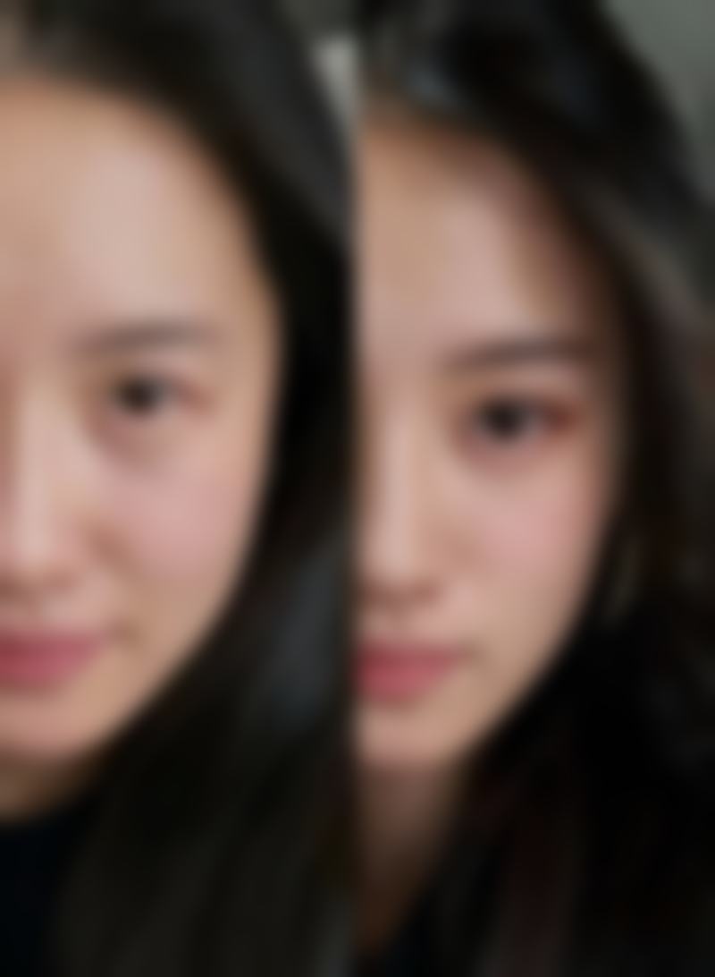 宁强县熙美女王整形医院患者评价