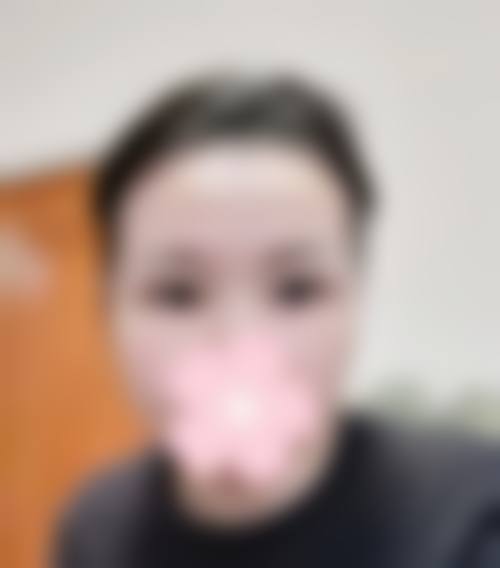 广州遇见你整形医院患者评价