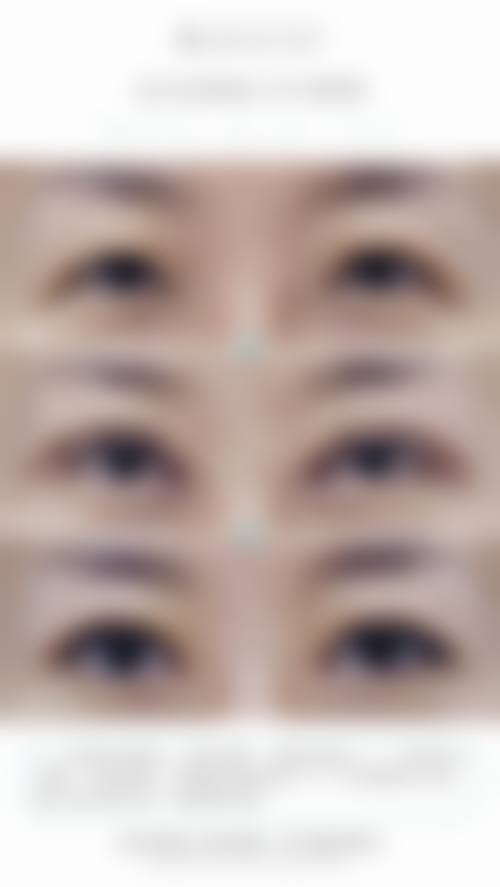 成都花度蜜美医疗美容诊所核心项目