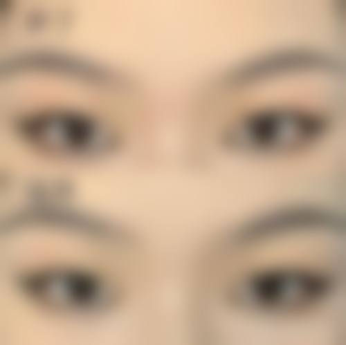 成都花度蜜美医疗美容诊所患者评价