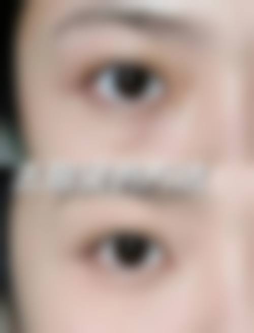 2026 河南灵宝维蜜医疗美容价格参考