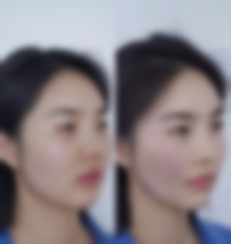 李埈旭擅长项目列表