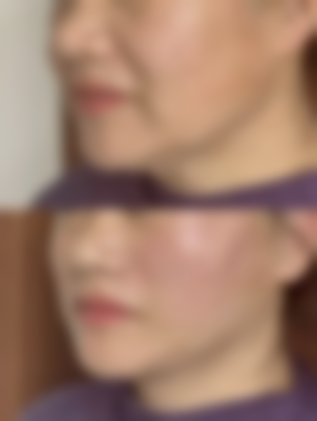 李埈旭患者评价