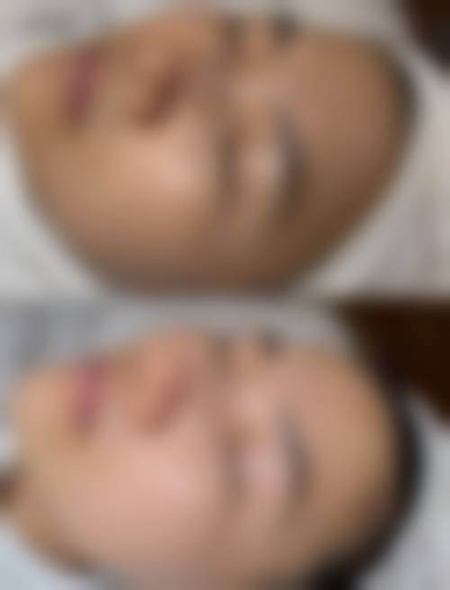 淮安那样美整形医院核心项目