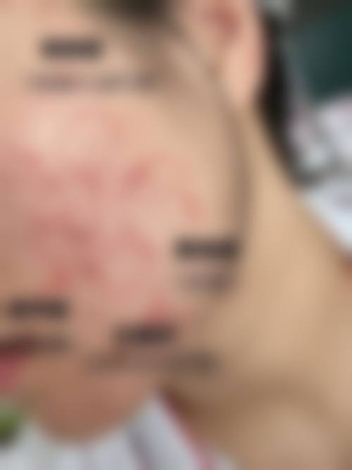 2026 扬州京城皮肤病医院医疗美容科价格参考