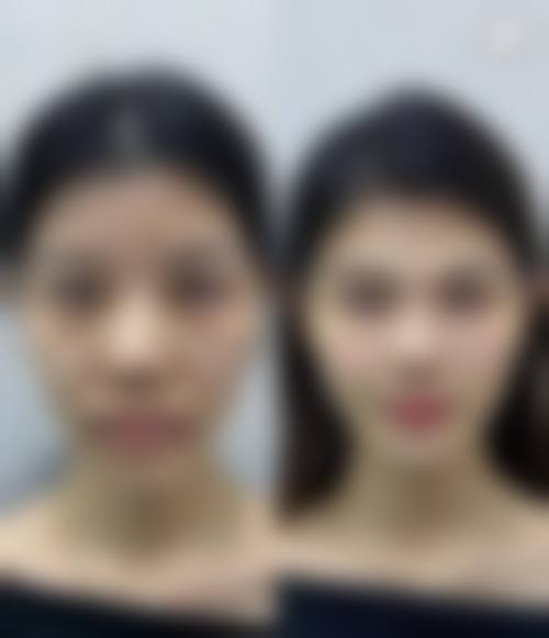 北京圣心医疗美容诊所核心项目