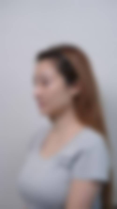 2026 大理伊美东方丽人医疗美容价格参考