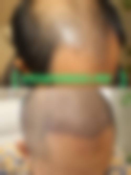 2026 桂林新华医疗美容整形中 心价格参考