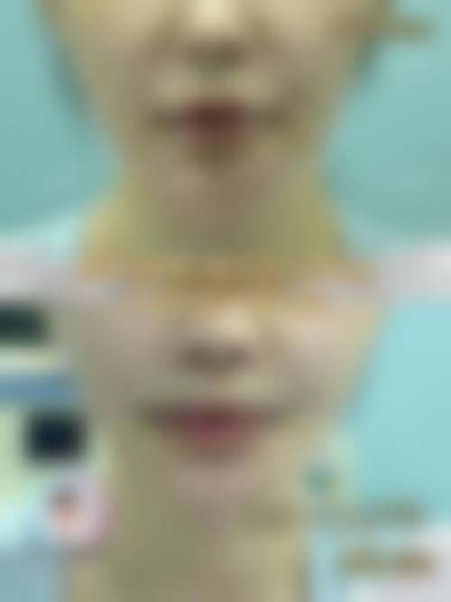 彝良县颜熹整形医院患者评价