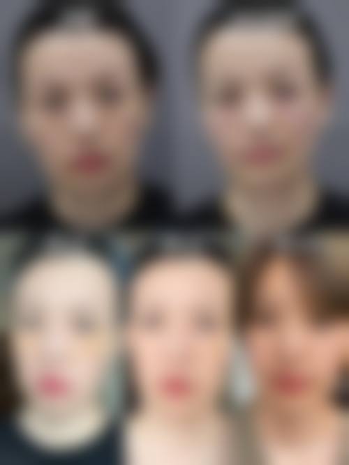 2026 成都高新美康婕熹卡整形医院价格参考