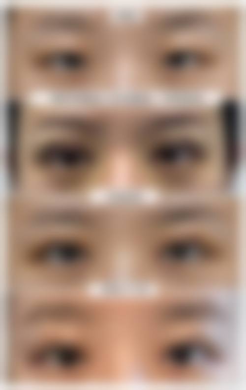 常州薇龄整形医院患者评价