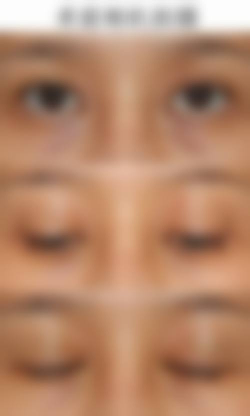 2026 北京汇恩整形医院价格参考