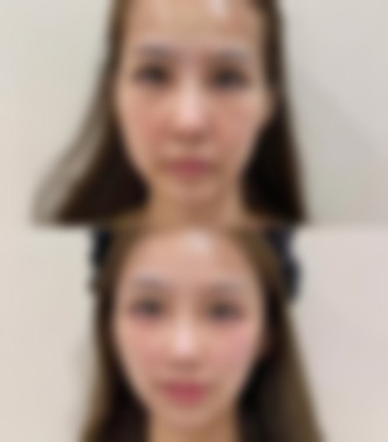 佛山颜瑾医疗美容诊所核心项目