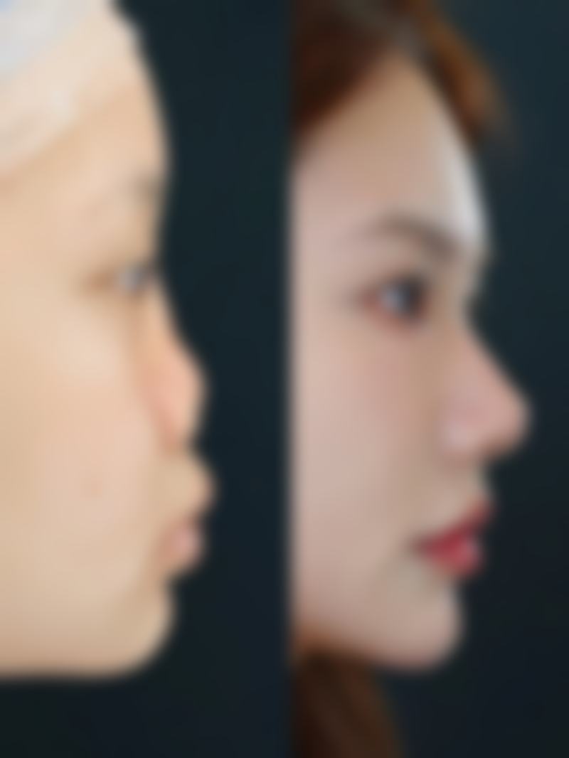 北京汇恩整形医院交通路线及预约