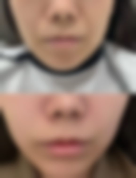 北京汇恩整形医院患者评价