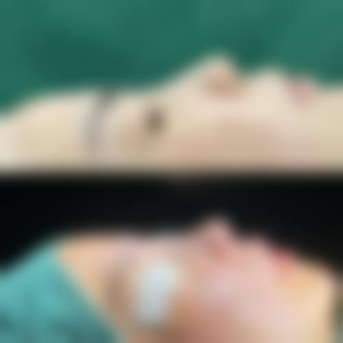 资阳韩美医疗整形美容医院患者评价