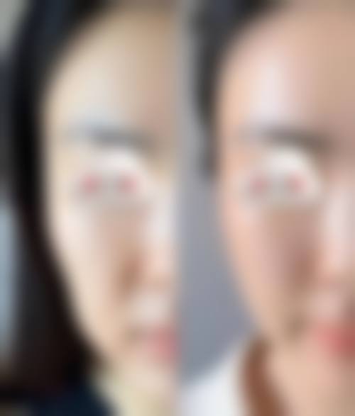 贵阳天使医院皮肤美容科患者评价