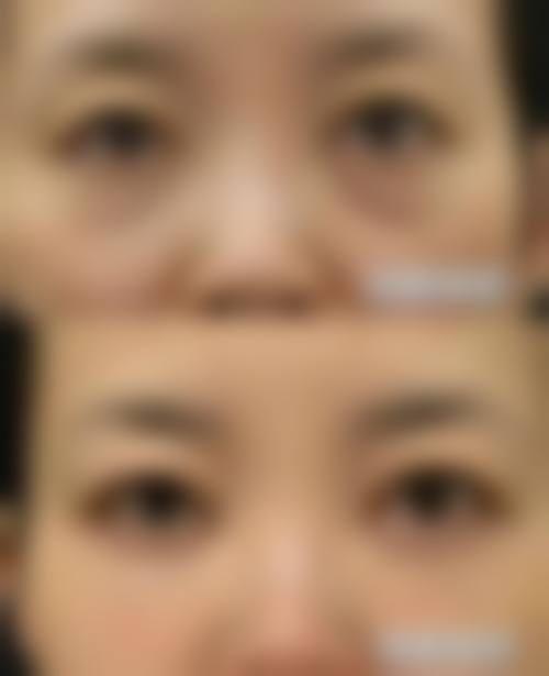 怀化德美整形美容门诊部患者评价