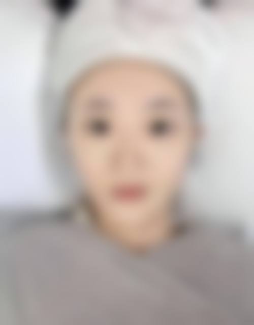 南京千秀美珏整形医院患者评价