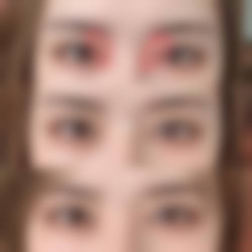 南京容易整形医疗美容诊所患者评价