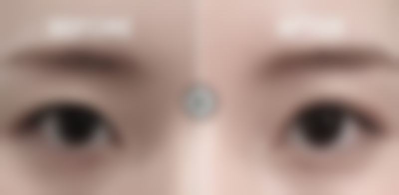 甘肃颜艺美医疗美容诊所患者评价