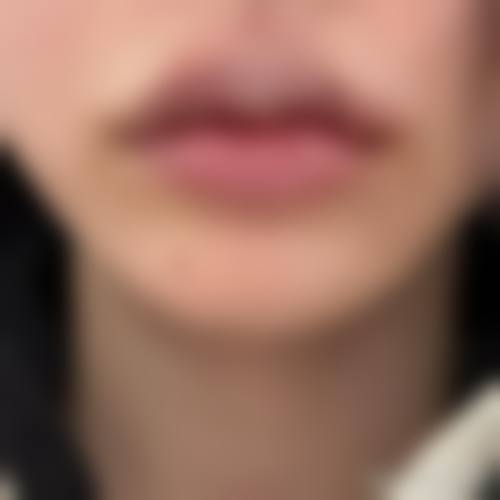 2026 台中米秝琪整形外科诊所价格参考