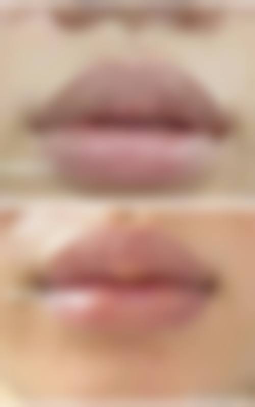 台中米秝琪整形外科诊所交通路线及预约