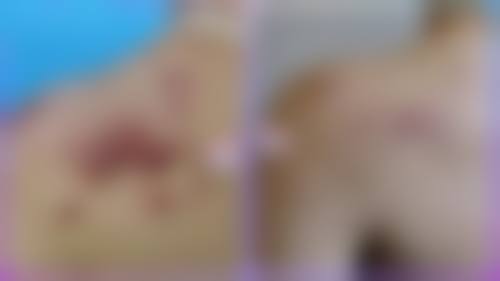 深圳欣悦美天医疗美容门诊部核心项目