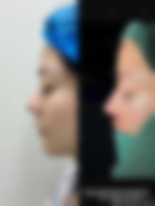 2025南昌大学第一附属医院整形美容科价格参考