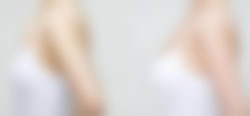 成都润熙整形医院患者评价