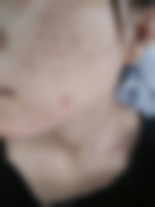 2026 深圳欣悦美天医疗美容门诊部价格参考