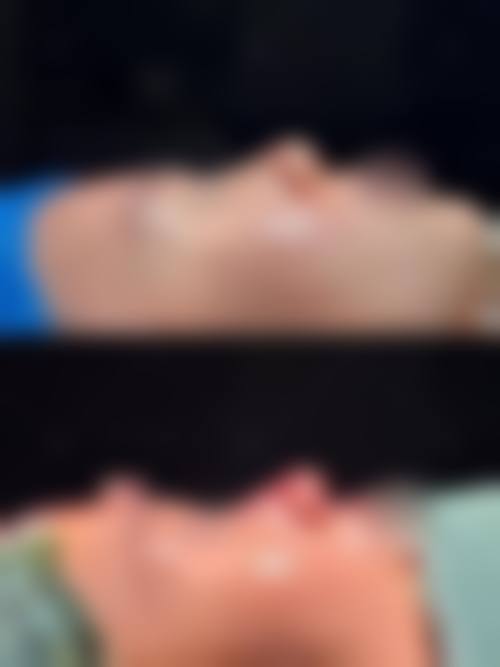 2026 菏泽市悦美美容医院价格参考