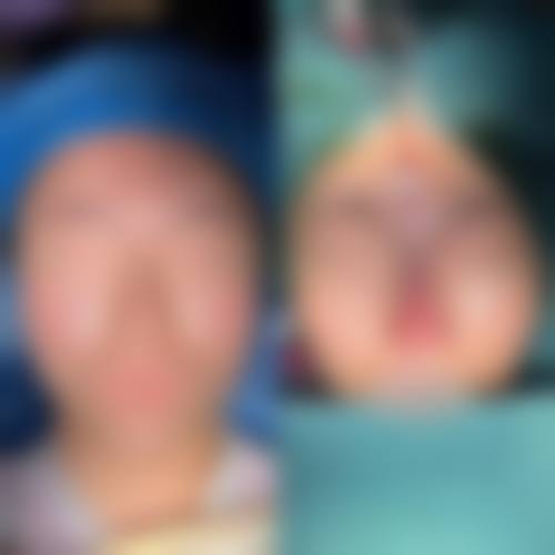 菏泽市悦美美容医院核心项目