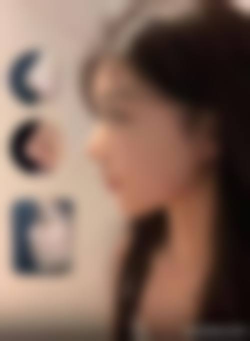 东莞天瑜整形医院患者评价