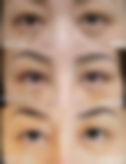 2026 东莞天瑜整形医院价格参考