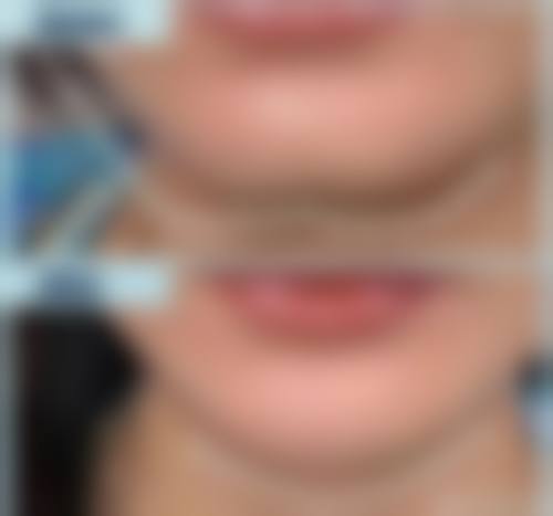 2026 巴彦淖尔李婉宁医疗美容诊所价格参考