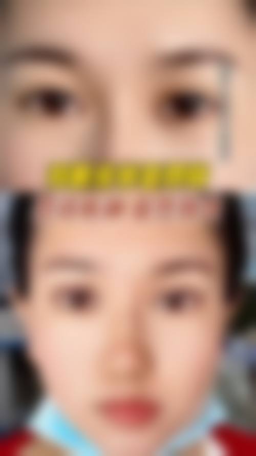 2026 呼和浩特王成毅整形医疗美容诊所价格参考