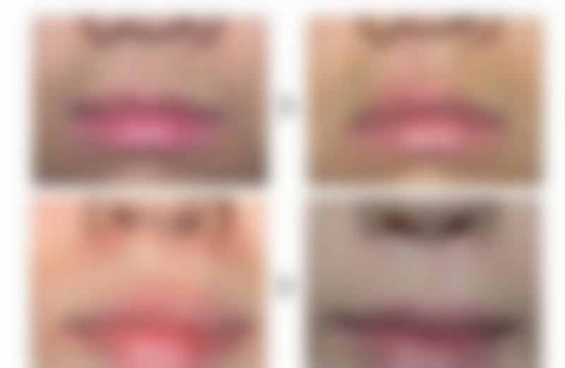 郑州德美整形医疗美容医院核心项目