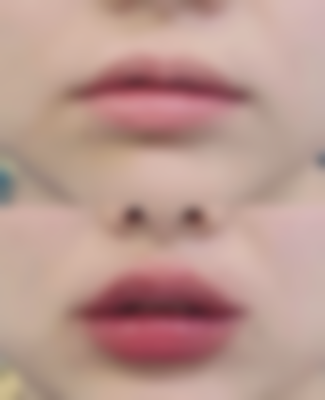 东莞天瑜整形医院核心项目