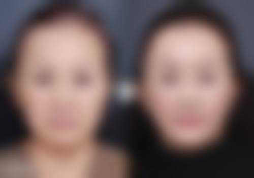 宫胜利技术水平评价