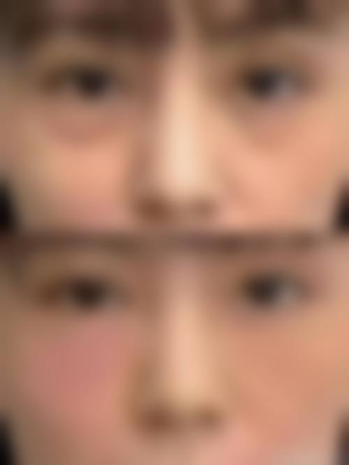 广州有鹿整形医院患者评价